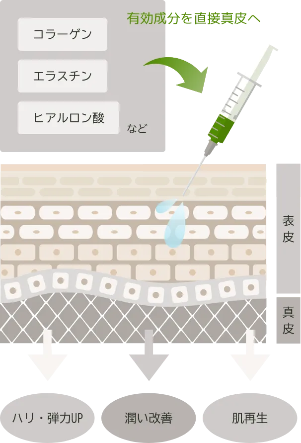 アプローチの説明